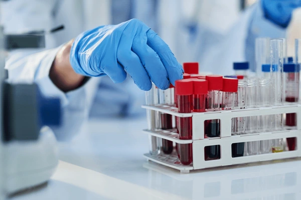 Blood Testing Lab